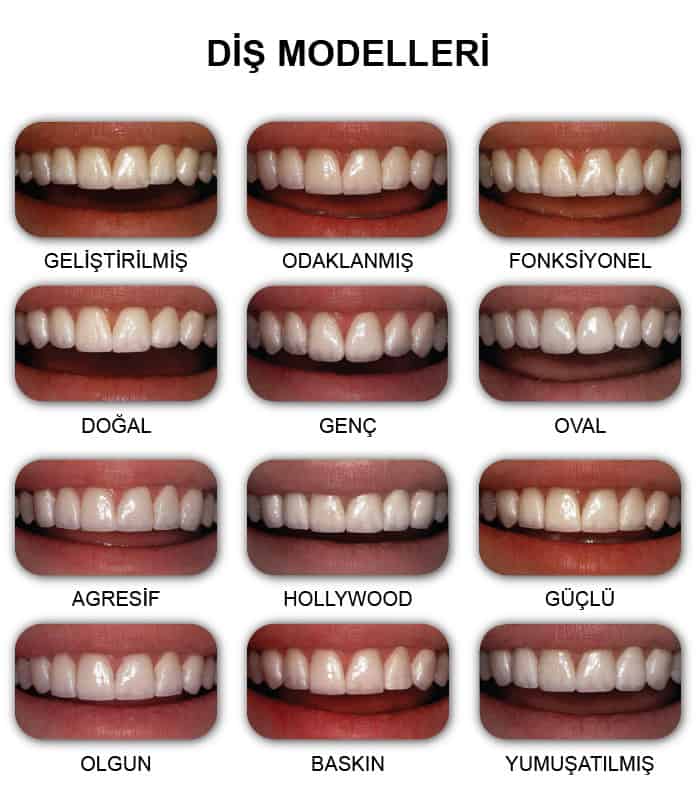 Diş Modelleri